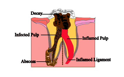 procedure-2