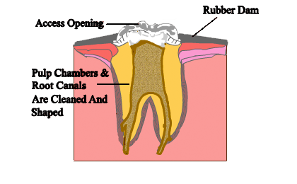 procedure-4