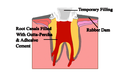 procedure-5